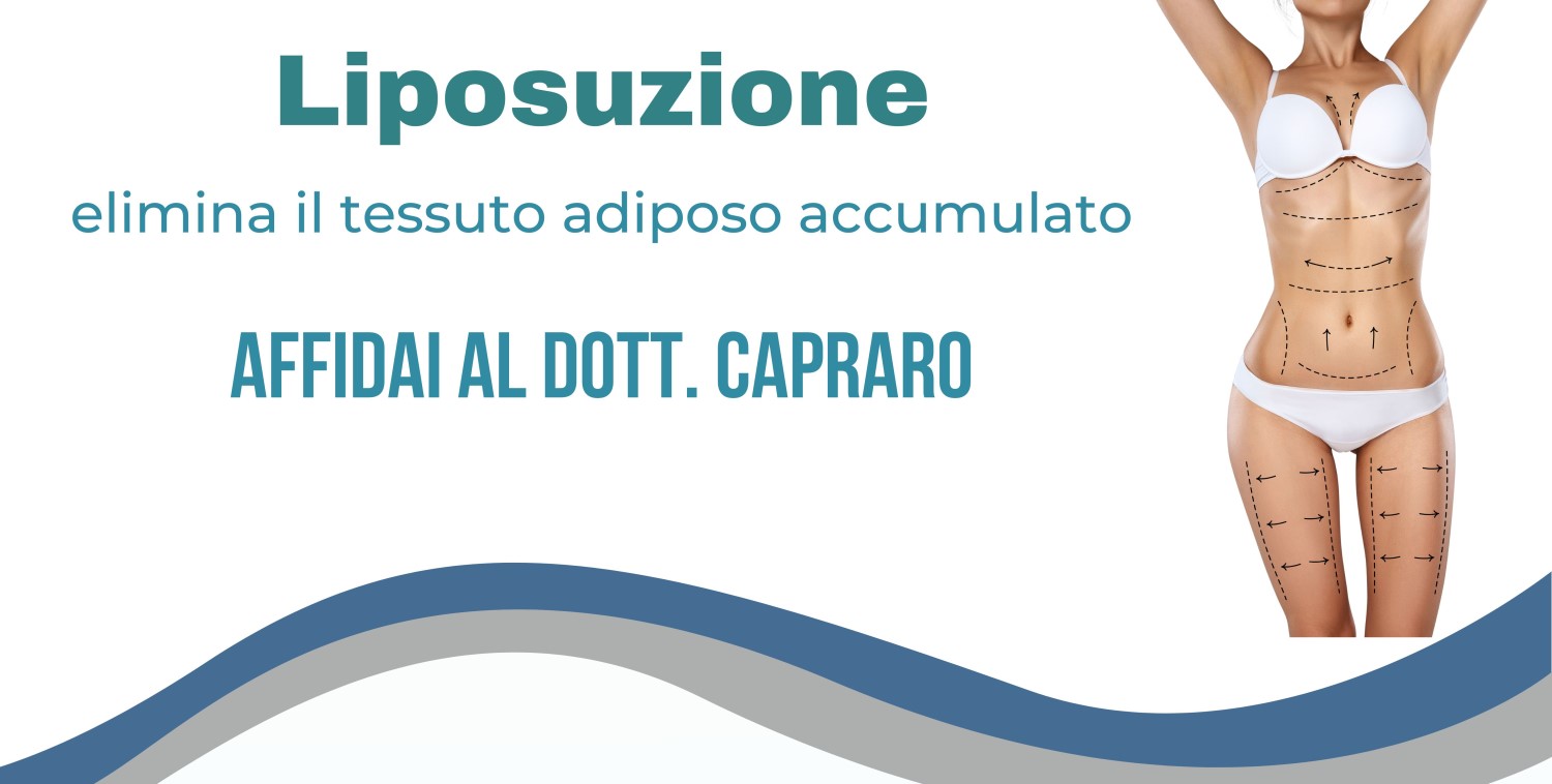 liposuzione